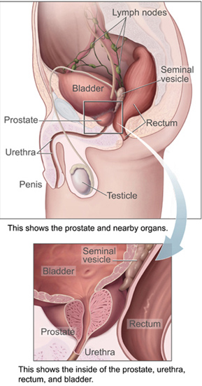 Image of prostate biology, By Created by US government agency National Cancer Institute - http://www.cancer.gov/cancertopics/wyntk/prostate/allpages#ab3d4f20-6ab9-4428-9717-067035d2e691, Public Domain, https://commons.wikimedia.org/w/index.php?curid=837427